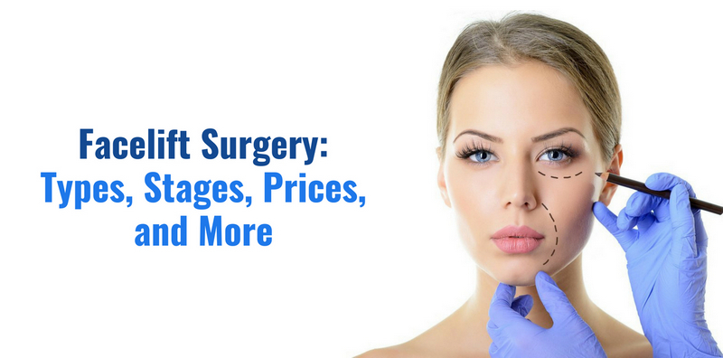 Facelift Surgery